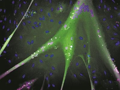 “永生”幹細胞培養肉誕生