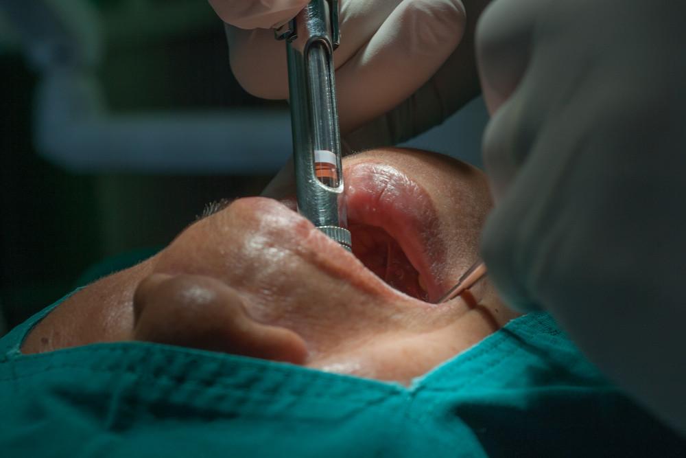 英媒：牙醫太缺，1/5英國人自己拔牙