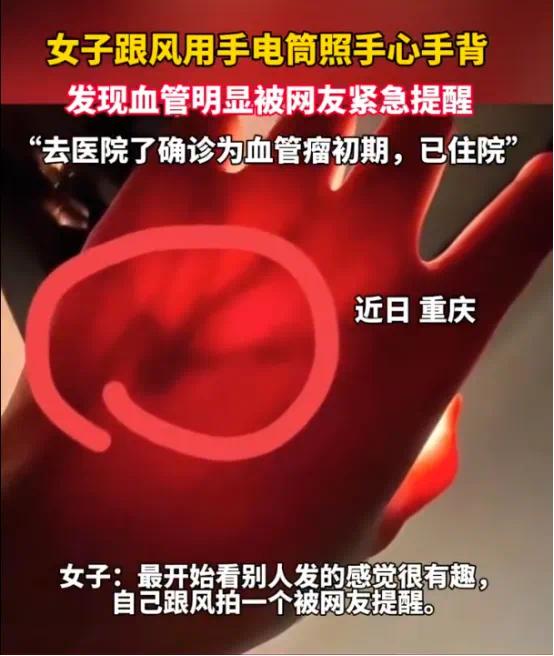 一張照片竟被網友看出血管瘤 身體出現這3個信號要當心
