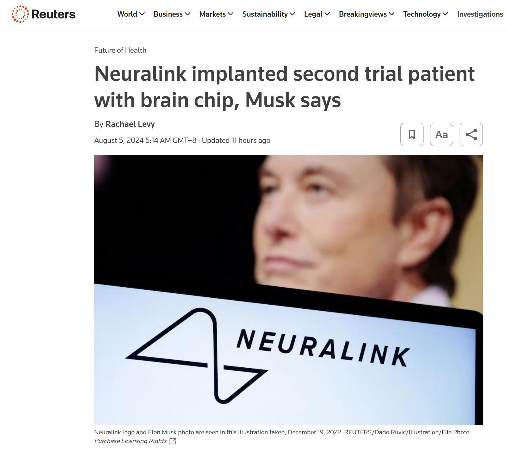 馬斯克：Neuralink今年將爲10名患者做腦機接口植入手術