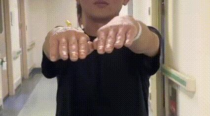 連續半個月熬夜+喝酒，35歲的他被確診爲“腦子壞了”！