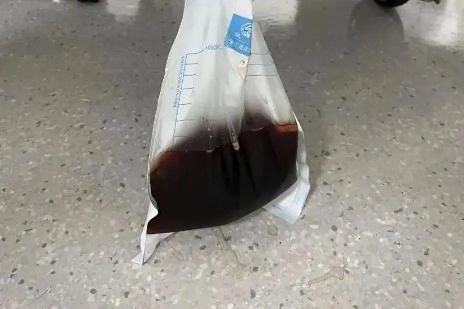 七旬“山林隱士”林間探險突遭橫禍！被TA蜇傷不可小覷，嚴重可喪命