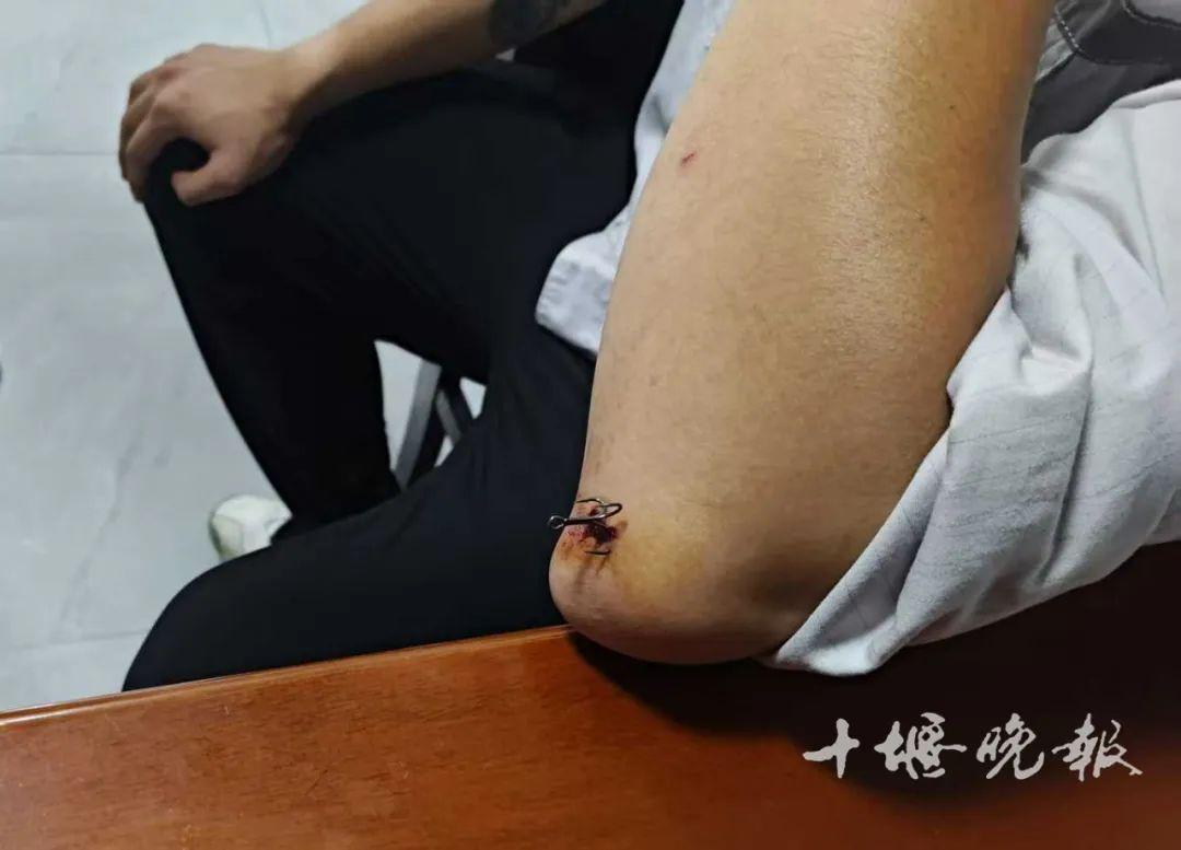 看着都疼！十堰男子胳膊被它鉤住，消防提醒