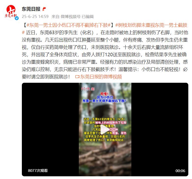 男子被樹枝刺傷右腳未重視，十餘天后全身休克……確診爲重度蜂窩織炎，右下肢截肢