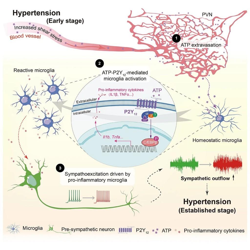 我國科學家發現高血壓患者交感神經興奮病因