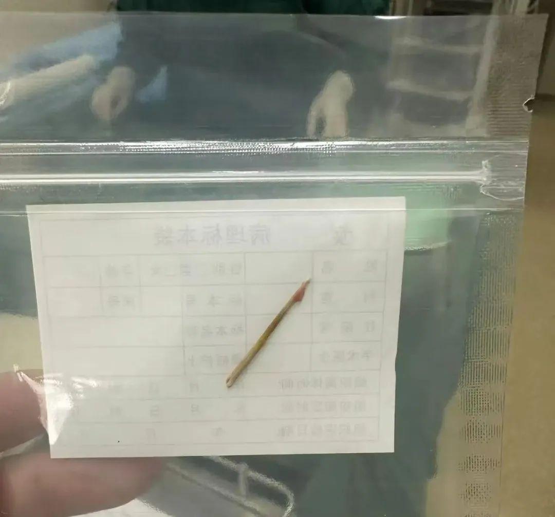 2歲女孩突然腹痛，去醫院一看令人心驚！不少孩子都有這個習慣