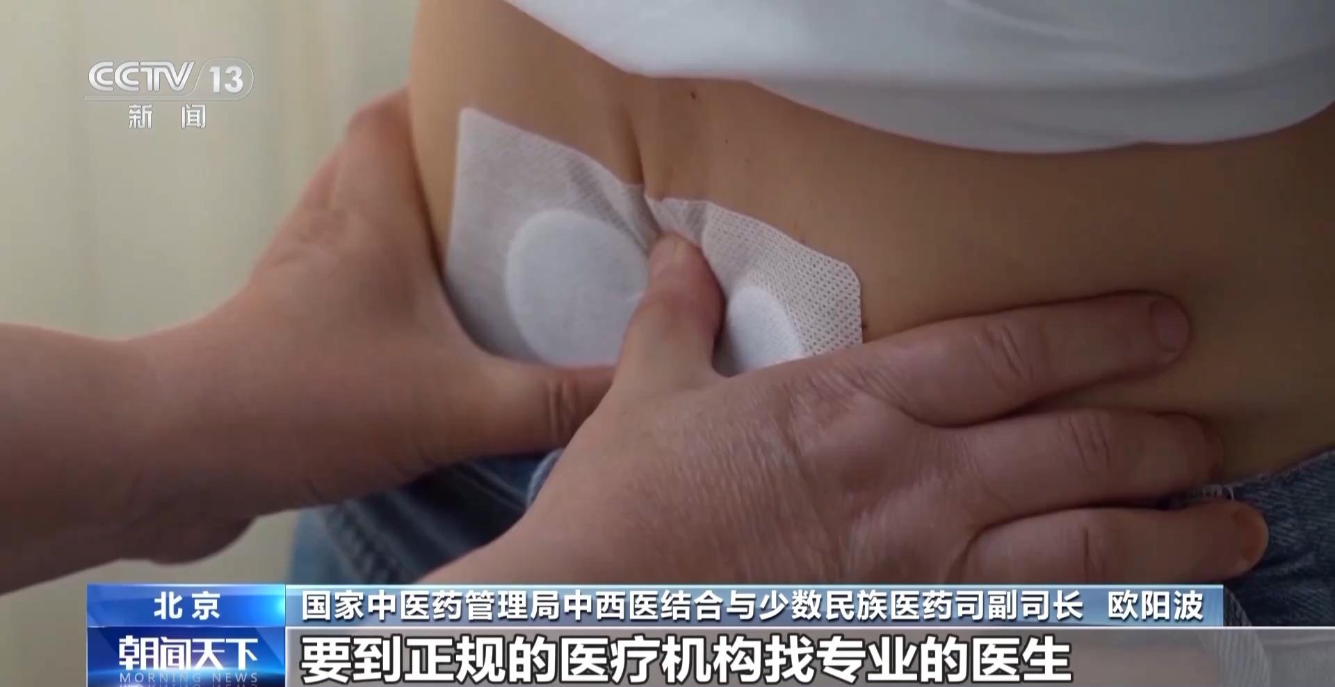 “三伏貼”究竟應該怎麼貼？國家中醫藥管理局特別提醒