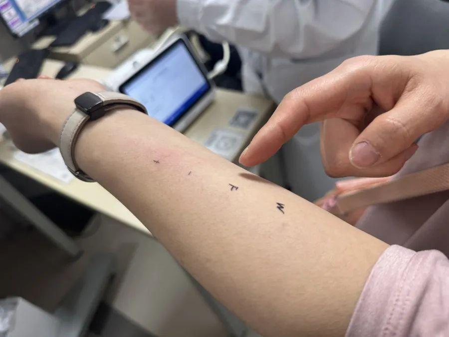發病後急劇惡化，男子差點窒息！近期高發，很難根治！張文宏發聲談過敏