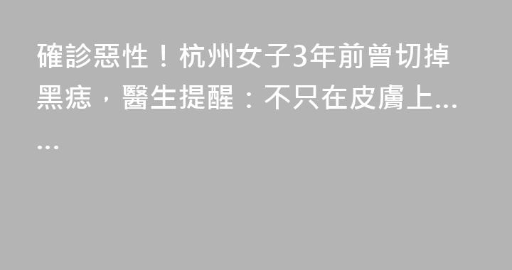 確診惡性！杭州女子3年前曾切掉黑痣，醫生提醒：不只在皮膚上……