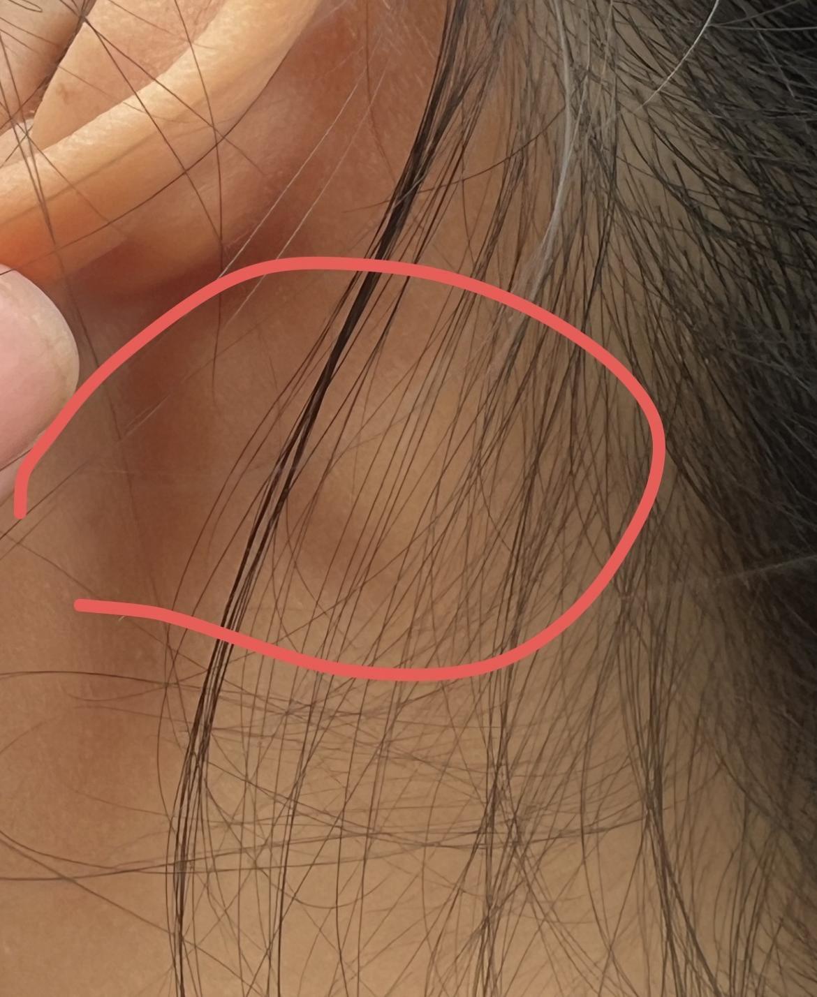 理完髮第三天，耳朵裏掏出一團棉絮，究竟是怎麼回事？