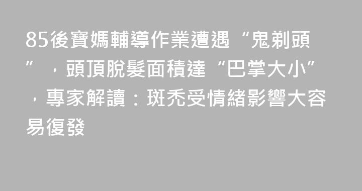 85後寶媽輔導作業遭遇“鬼剃頭”，頭頂脫髮面積達“巴掌大小”，專家解讀：斑禿受情緒影響大容易復發