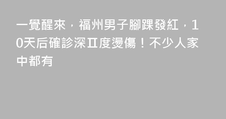 一覺醒來，福州男子腳踝發紅，10天后確診深Ⅱ度燙傷！不少人家中都有